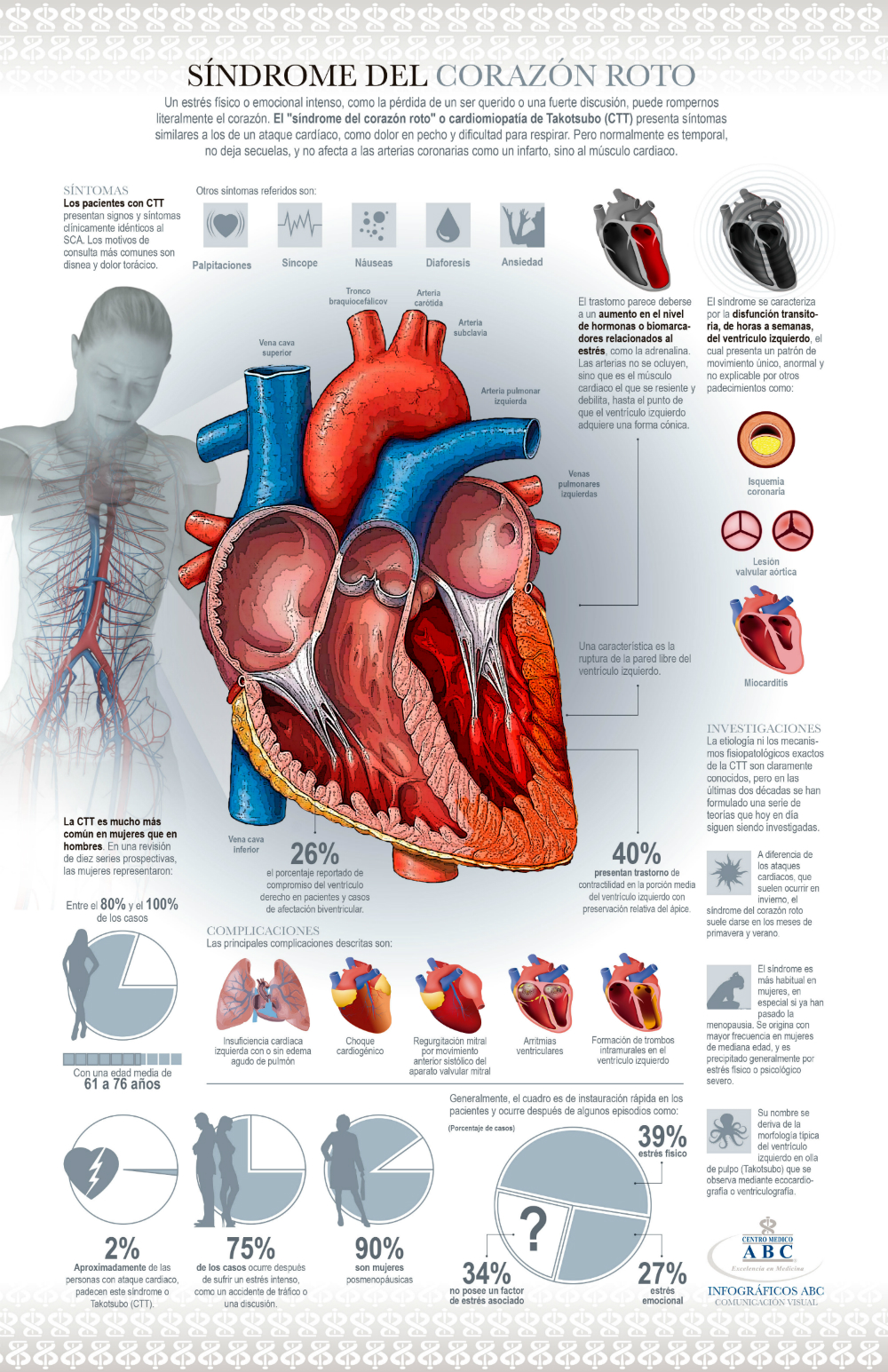 Infografía-Síndrome-del-corazón-