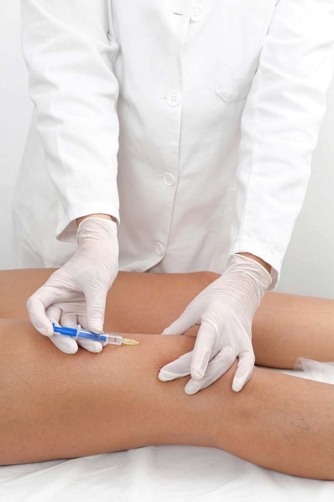carboxiterapia