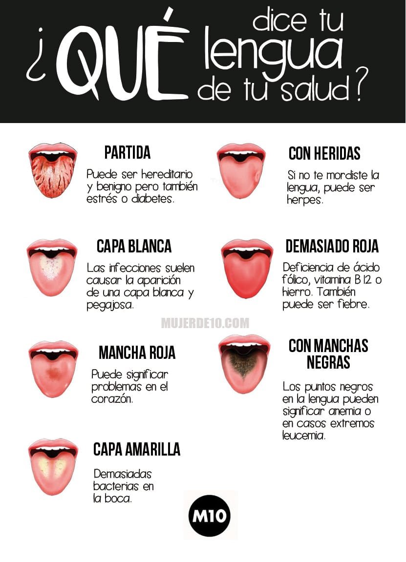 Lo que dice tu lengua de tu salud 0