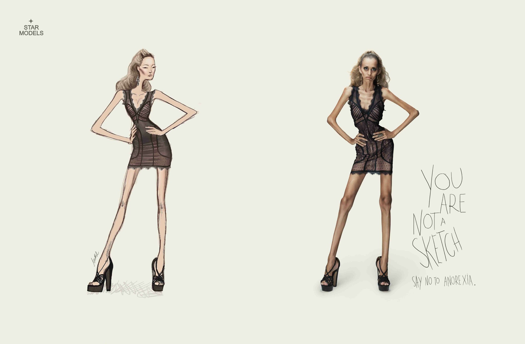 Star Models campaña vs anorexia 2