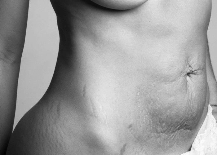 beautiful-body-project
