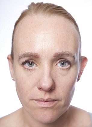 fml-anna pursglove ‘after surgery eyebrow’-15.jpg