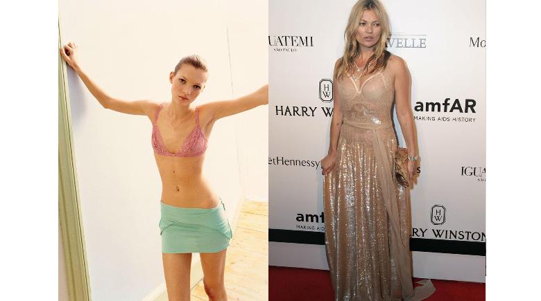 10-famosas-que-han-sufrido-de-anorexia (9)