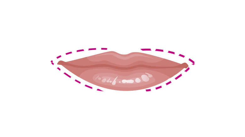 labios pequeños