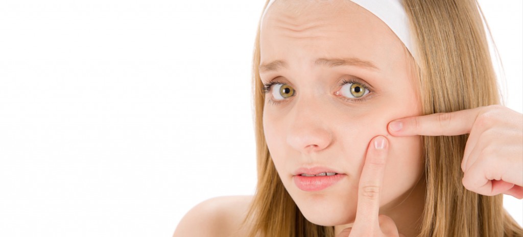 ¿Qué tenemos que hacer ante el acné?