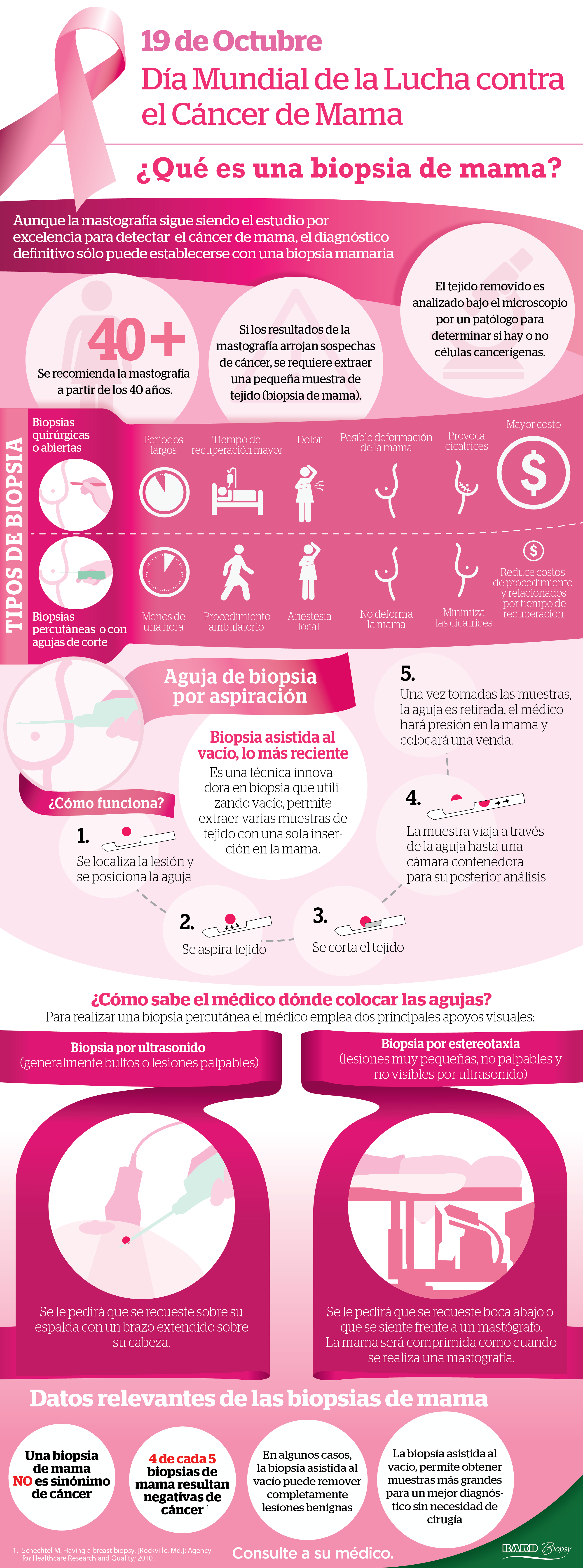 biopsia cancer de mama