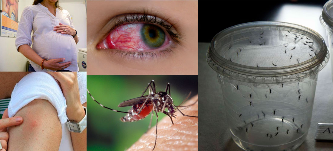 ¿Qué es el virus zika y cuáles son sus síntomas?