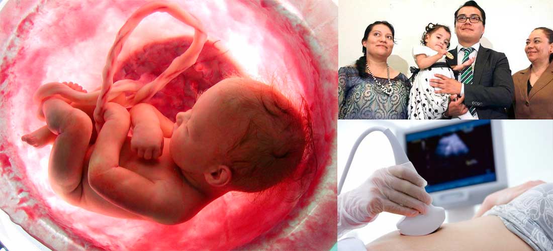 Lo más nuevo: Cirugía fetal en México