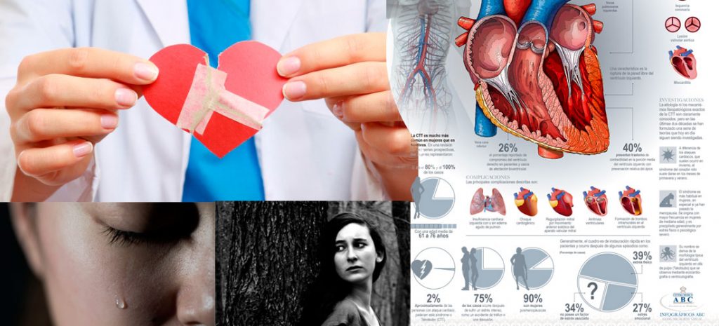 ¿Por qué es peligroso para las mujeres el síndrome del corazón roto?