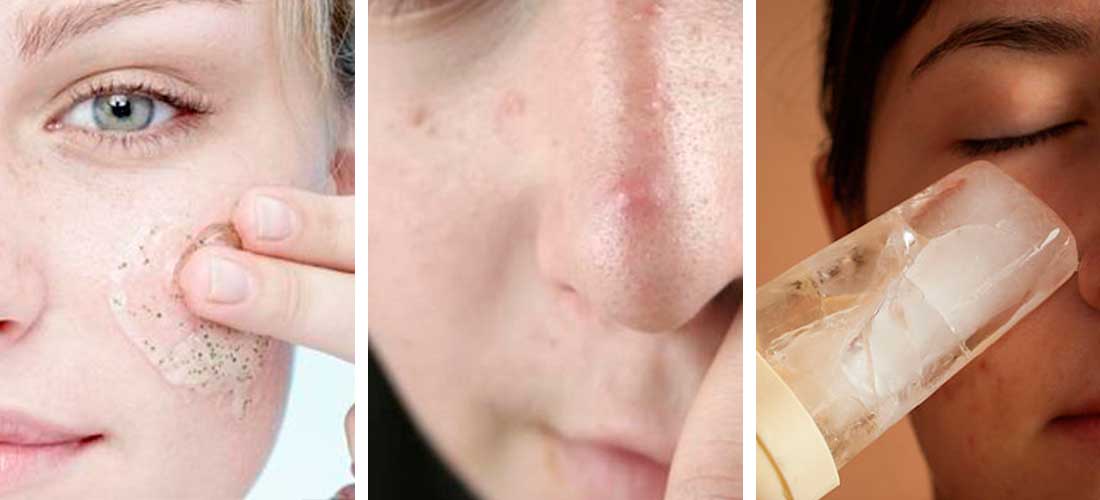 4 usos del hielo en tu piel que te sorprenderán