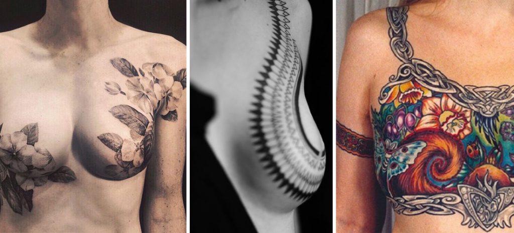 Los tatuajes que transformaron cicatrices de cáncer de mama en arte