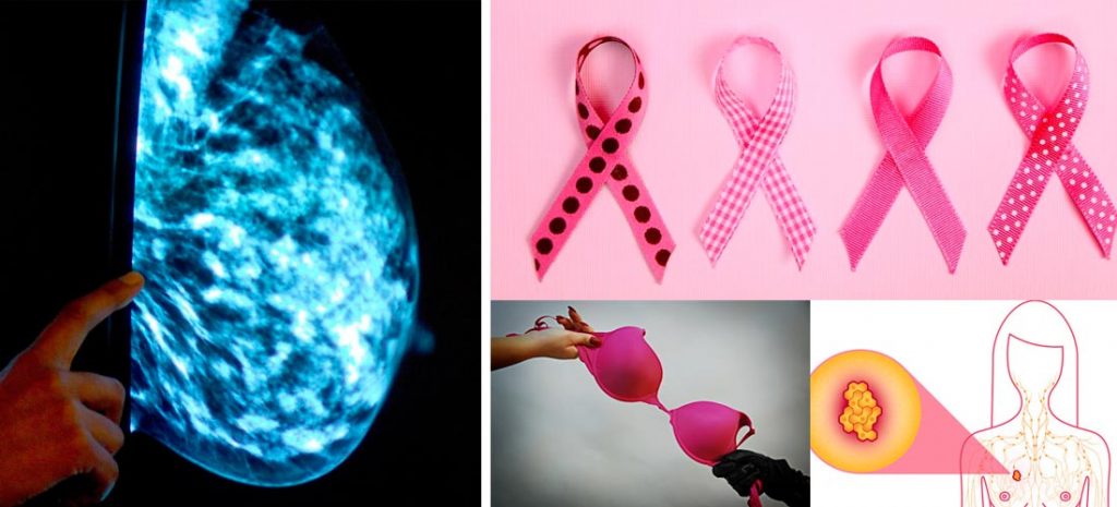 6 mitos sobre el cáncer de mama que debes conocer