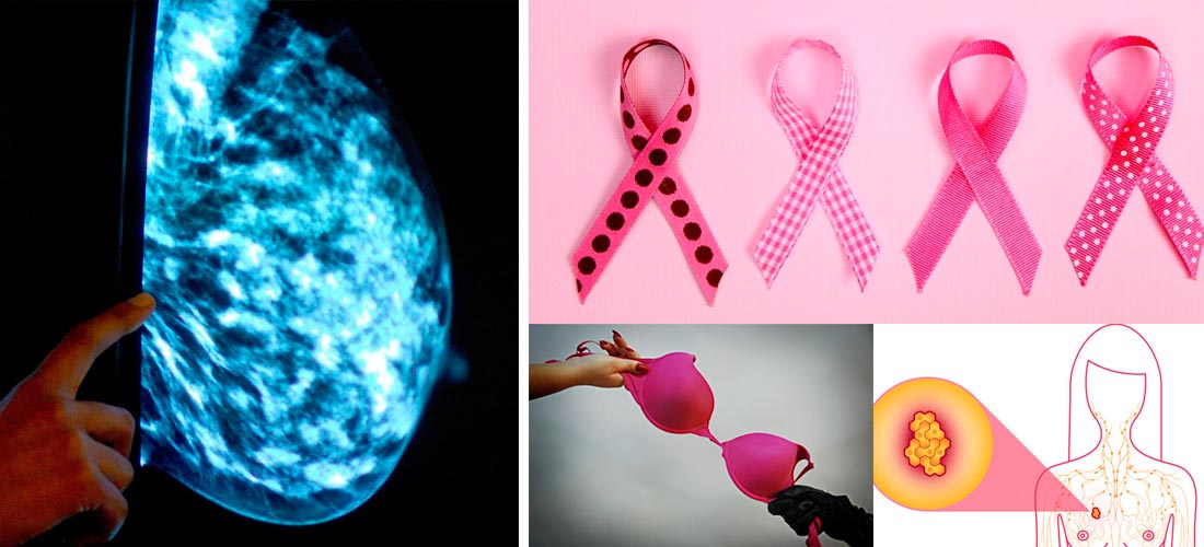 6 mitos sobre el cáncer de mama que debes conocer
