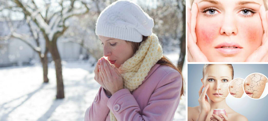 5 productos para piel reseca en invierno