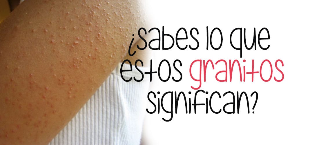 Esta es la razón por la que tienes granitos en los brazos