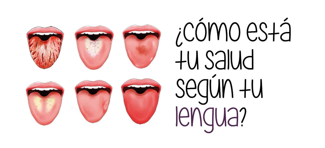 Lo que dice tu lengua de tu salud