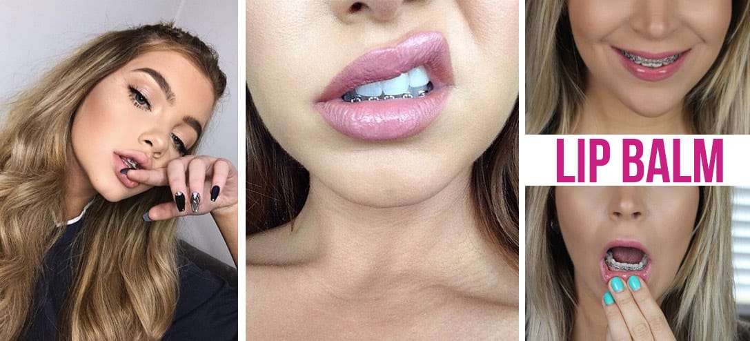 Tips de belleza para mujeres con brackets