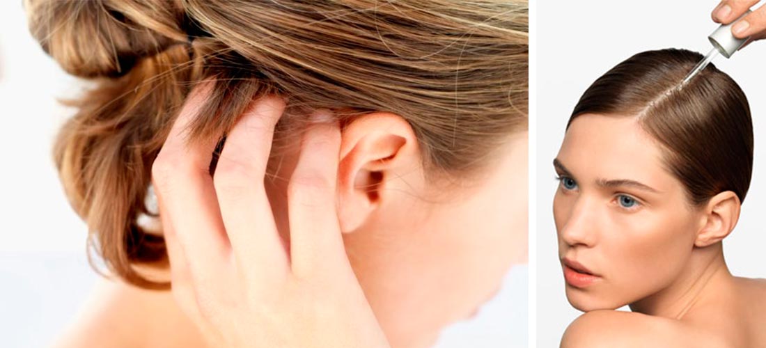 Los mejores 5 shampoos para reparar el cabello maltratado 5
