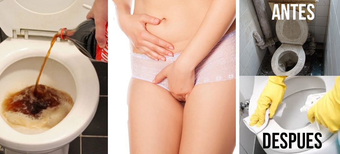 Cómo lavar tu inodoro para evitar infecciones vaginales