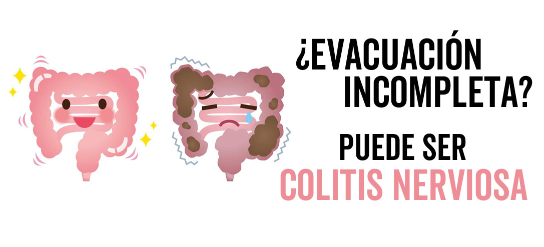 Síntomas que indican tienes colitis nerviosa