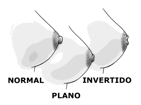Los 7 tipos de pezones que existen y debes conocer 0