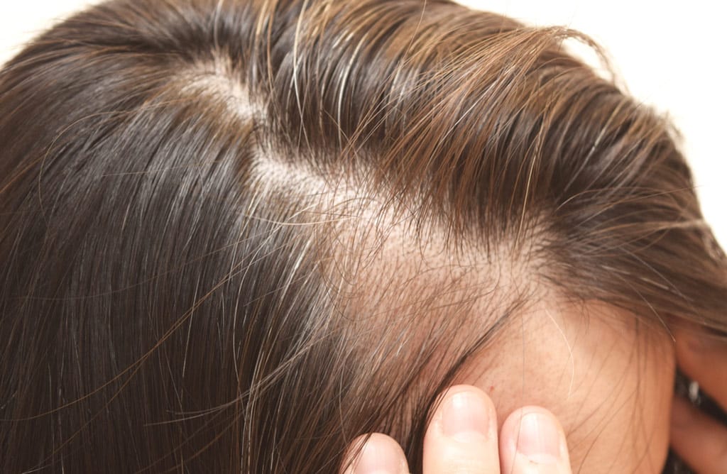 Beneficios del jengibre para el cabello que debes conocer 2