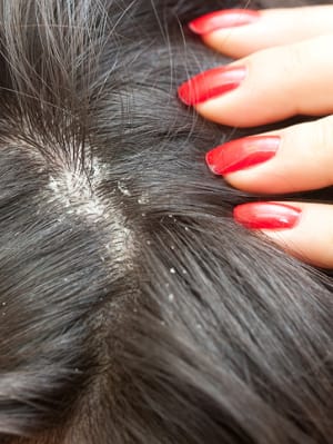Beneficios del jengibre para el cabello que debes conocer 1