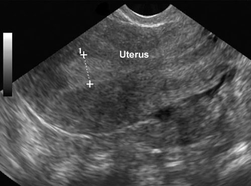 forma de menstruar