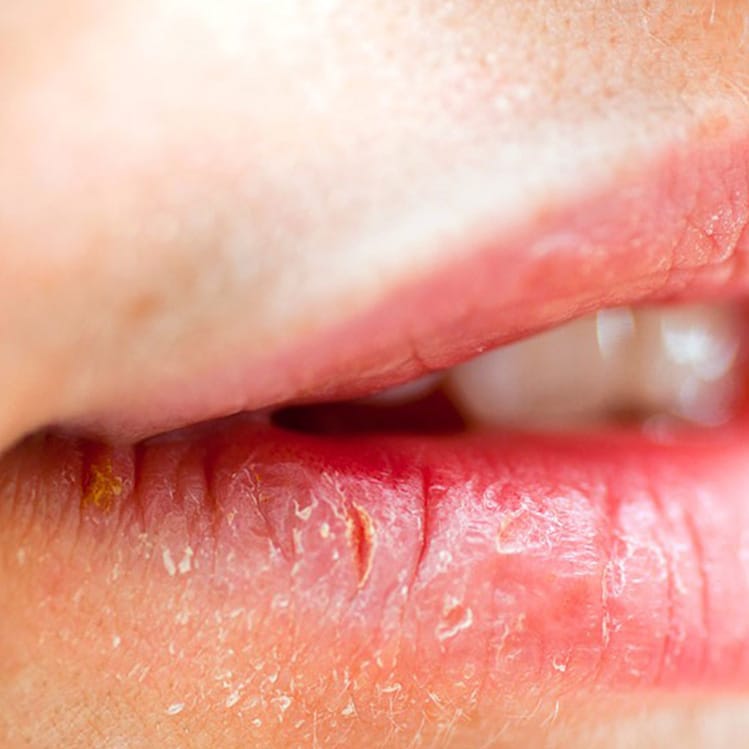 7 Remedios caseros para labios secos que te los dejarán super suaves