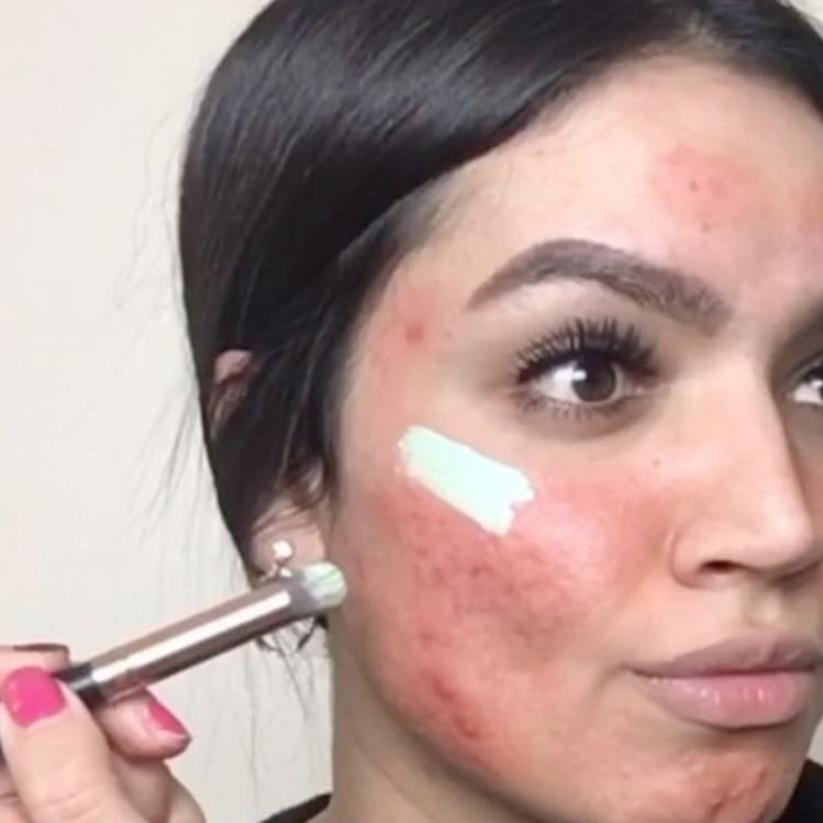 bases de maquillaje para chicas con acné