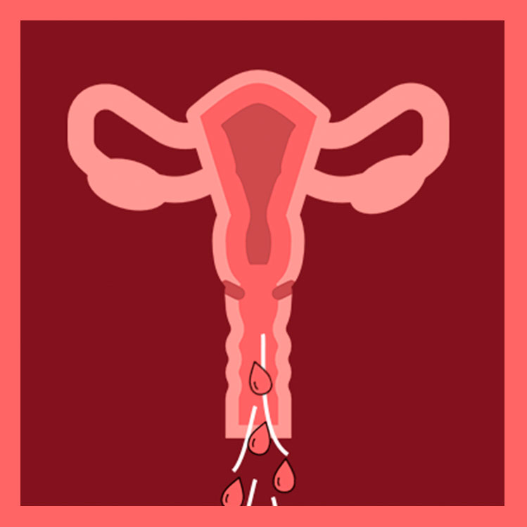 Aspirar la menstruación: la nueva y peligrosa tendencia para cortar la regla