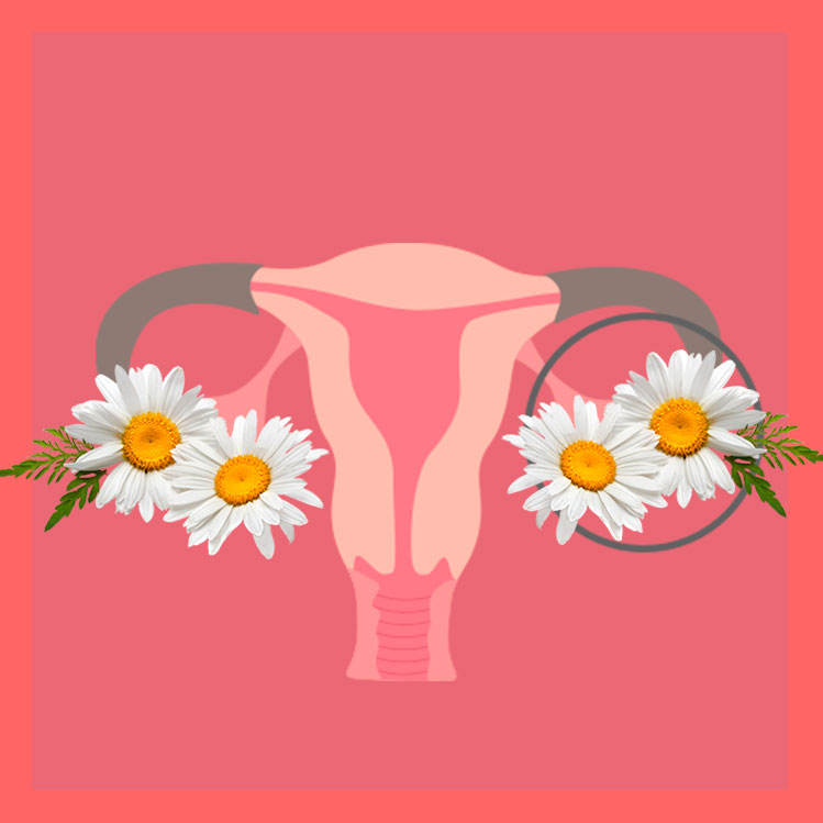 5 remedios caseros para eliminar los quistes de ovario