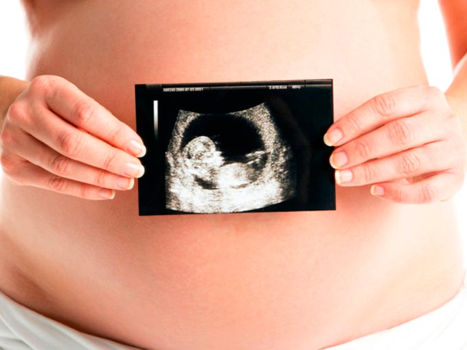 embarazo-infertilidad-secundaria