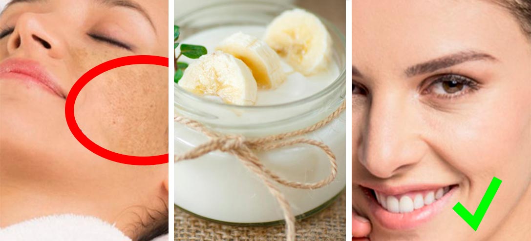 mascarilla-platano-rostro