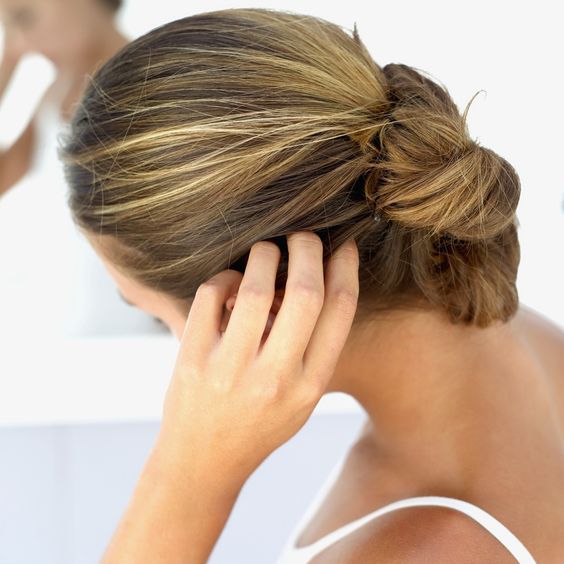 5 consejos si sufres de caspa en el cabello 0