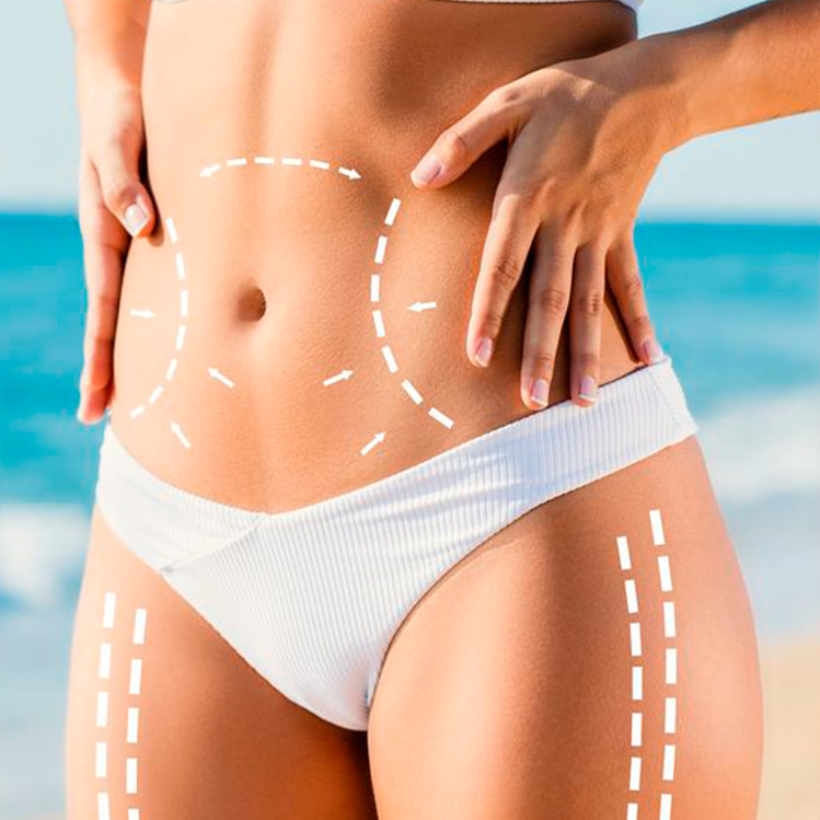 ¡No es tan fácil! Checa 10 mitos y realidades sobre hacerte la lipo