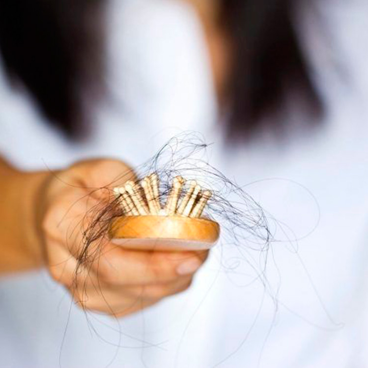 Tips para cuidar tu cuero cabelludo para evitar la caspa