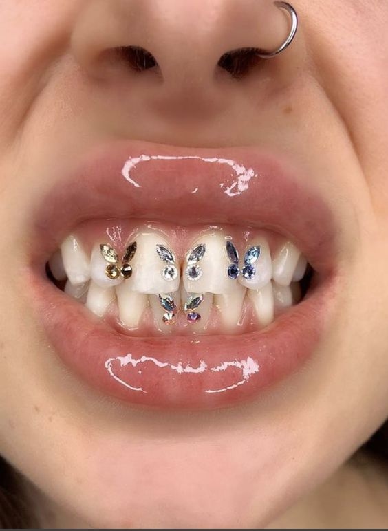 7-disenos-de-dientes-con-gemas-la-nueva-tendencia-de-2022