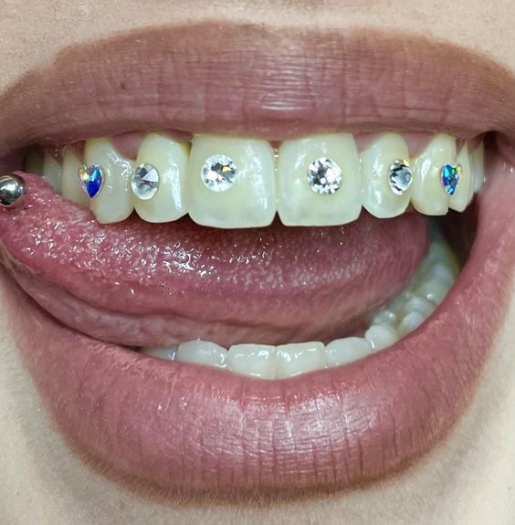 7-disenos-de-dientes-con-gemas-la-nueva-tendencia-de-2022