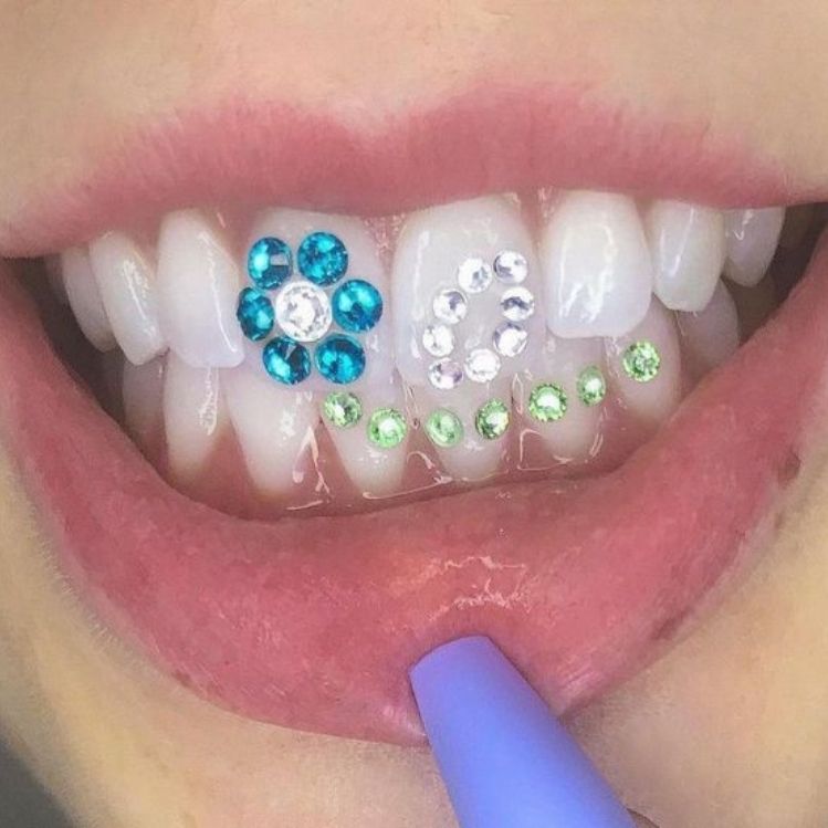7 diseños de dientes con gemas ¡la nueva tendencia de 2022!