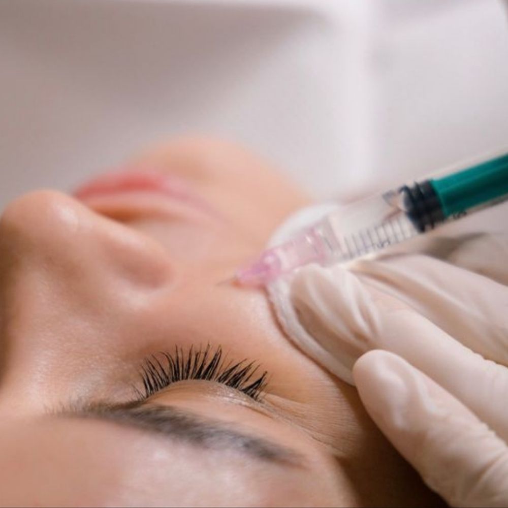 Botox vs ácido hialurónico ¿qué funciona más para evitar arrugas?