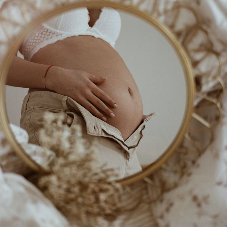 10 cremas para prevenir la aparición de estrías en tu embarazo