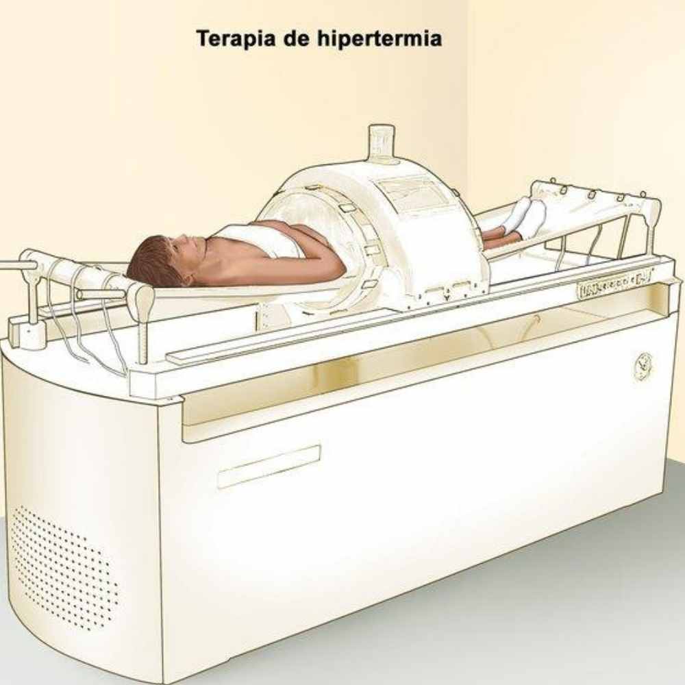 Ilustración que ejemplifica cómo funciona la quimioterapia térmica