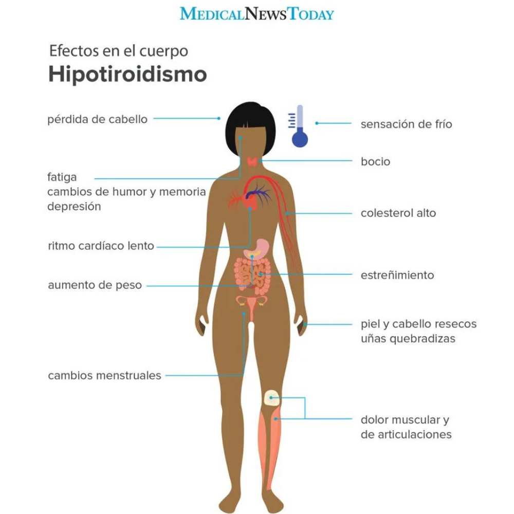 Enfermedades tiroideas en mujeres que afectan a la salud 0