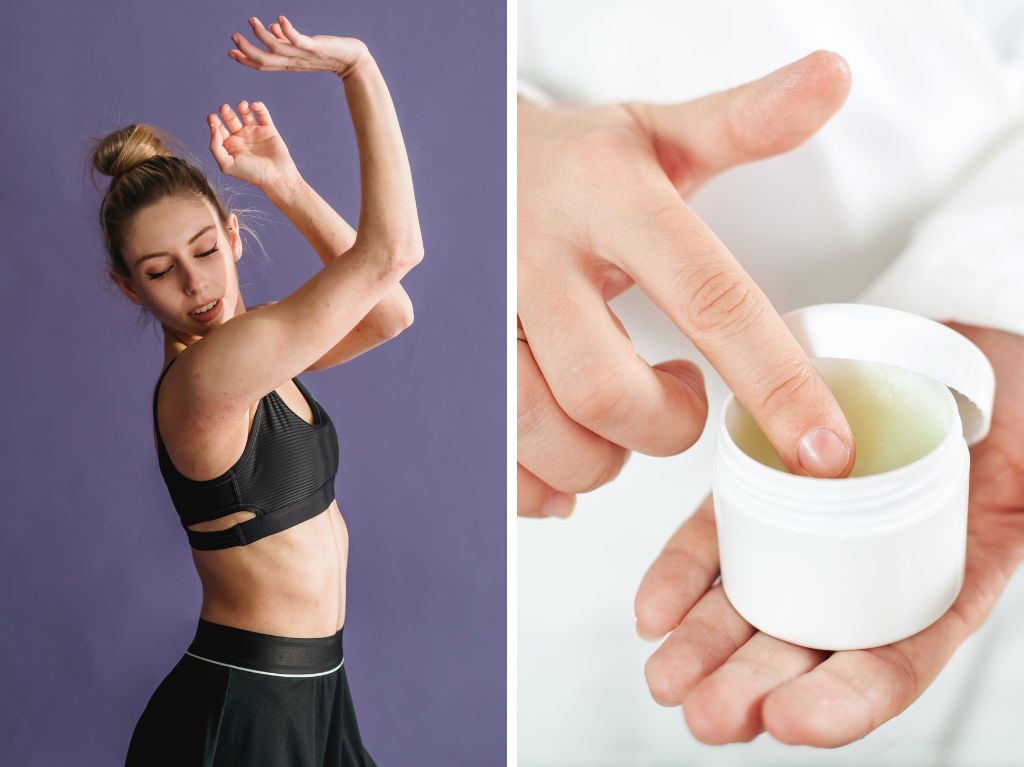 Cómo adelgazar los brazos con Vick Vaporub
