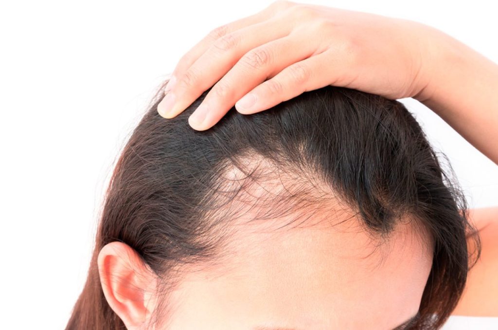 Caída de cabello: 5 productos ideales para combatir esta problemática 0