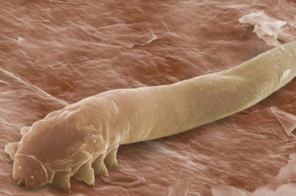 Demodex el ácaro que se puede estar comiendo tus pestañas 1