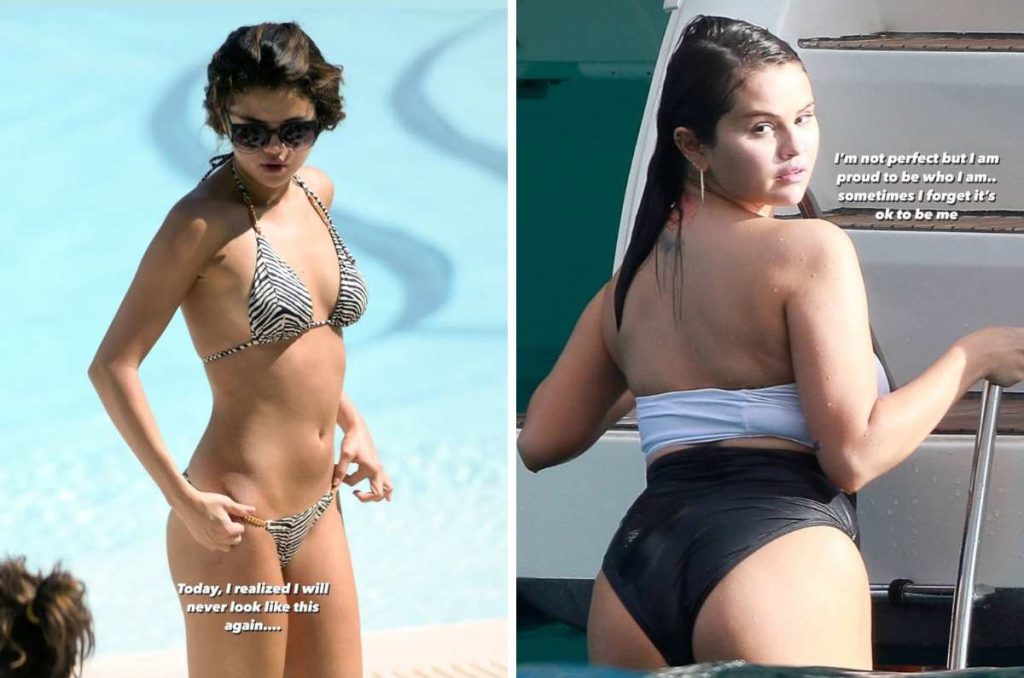 antes y después Selena Gómez