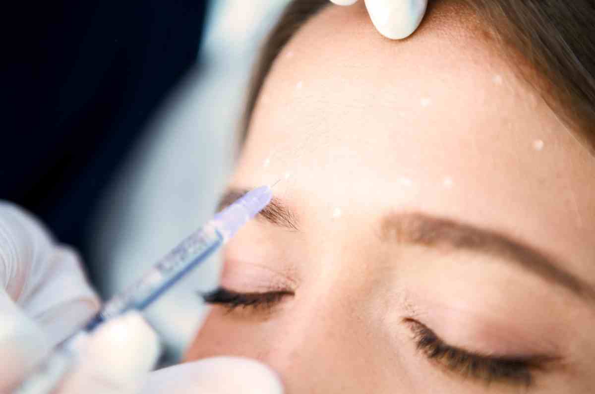 Qué es el Baby Botox y cuáles son sus beneficios