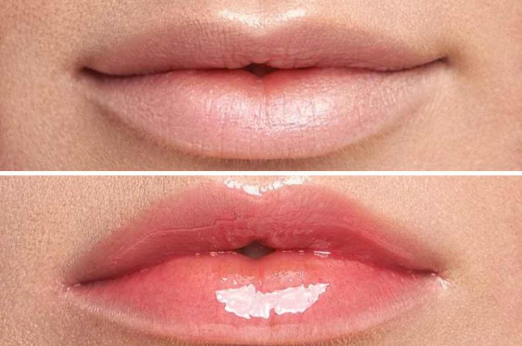 Lips plumpler: la alternativa para unos labios gruesos sin cirugía 1